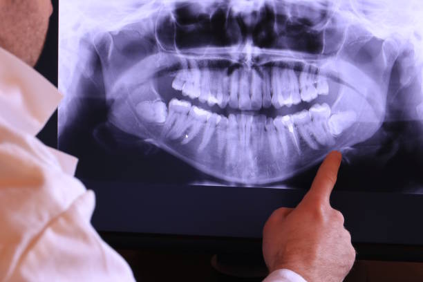 Best After-Hours Emergency Dentist in Robersonville, NC