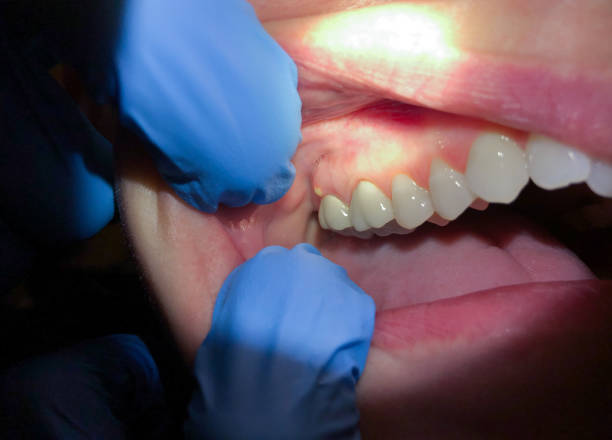 Best Weekend Emergency Dentist in Robersonville, NC