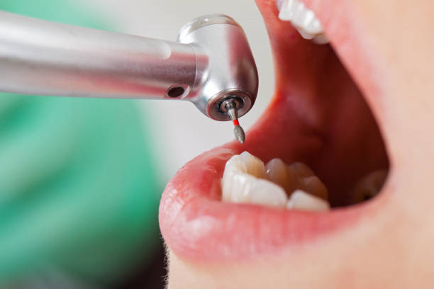 Best Emergency Root Canal Treatment in Robersonville, NC